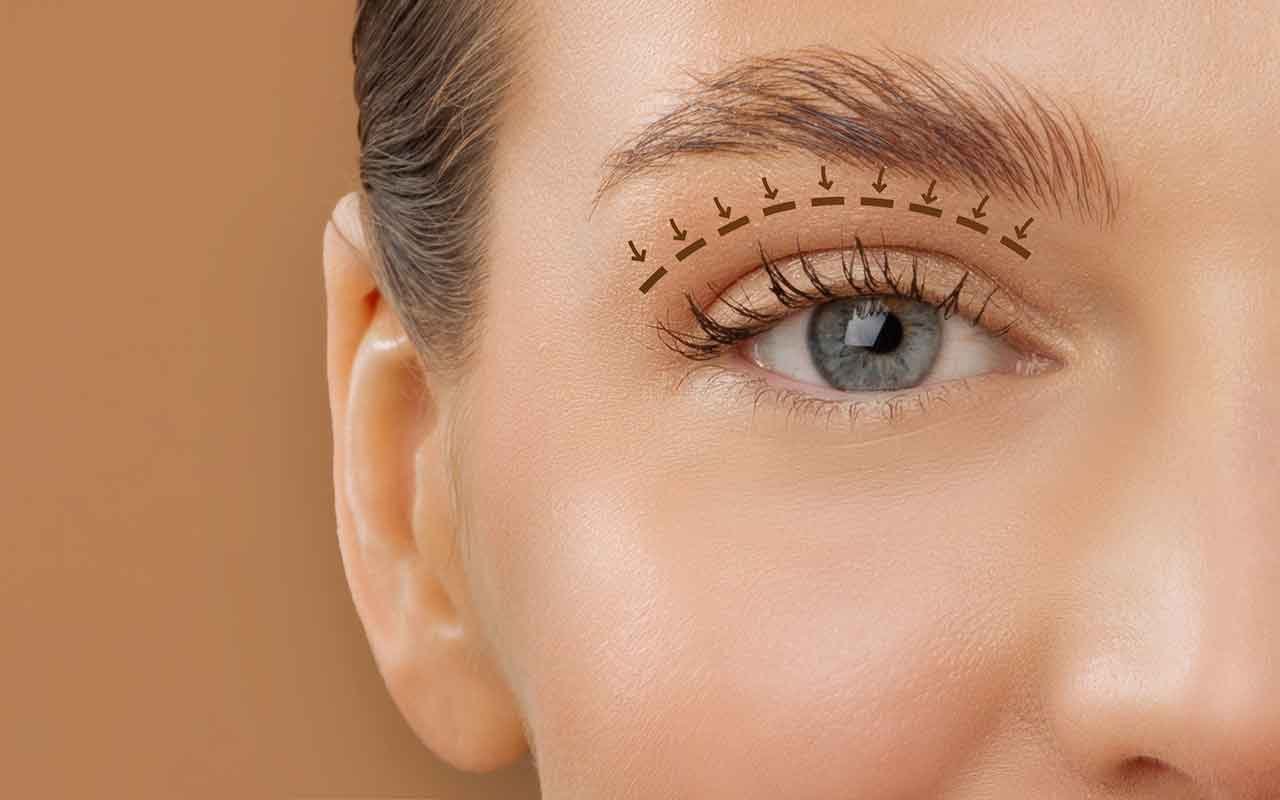 Qu’est-ce que la blépharoplastie exactement