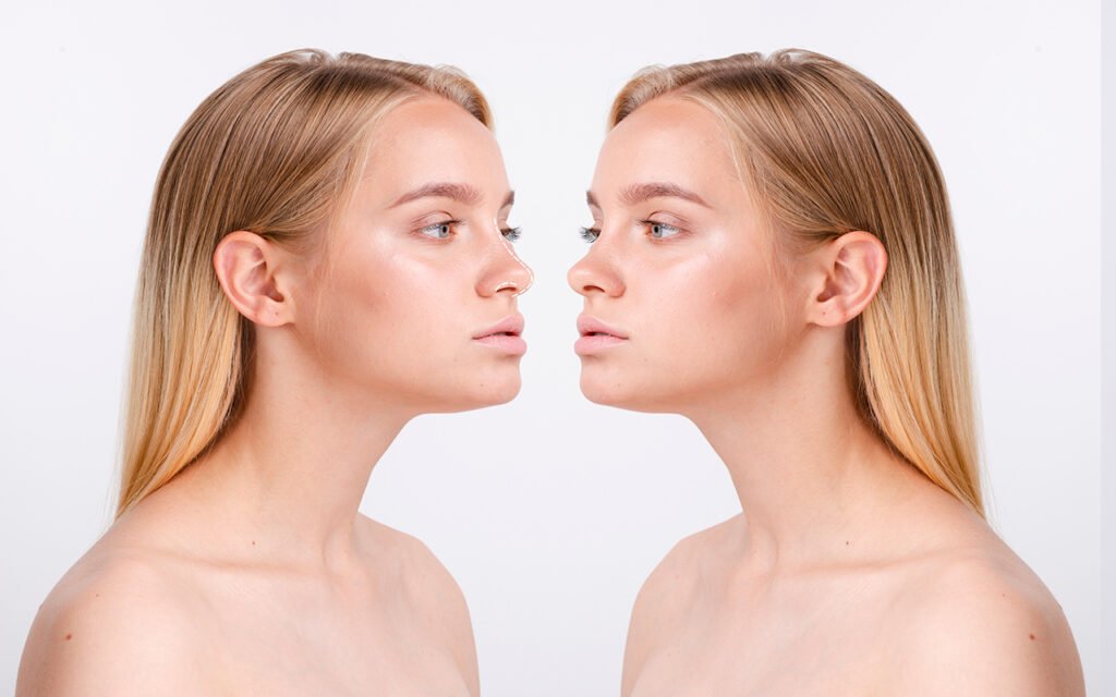 Rhinoplastie en Tunisie : le pack tout inclus pour changer de profil sans stress