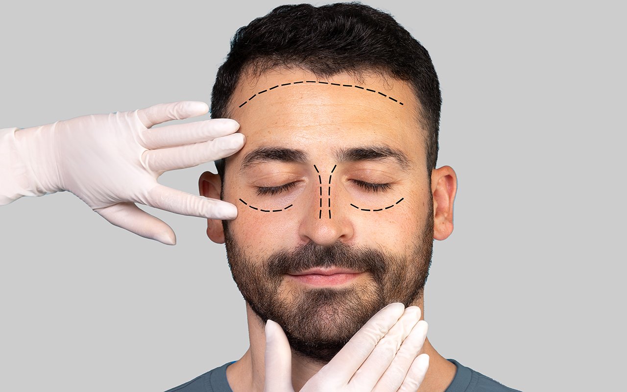 Rhinoplastie masculine en Tunisie