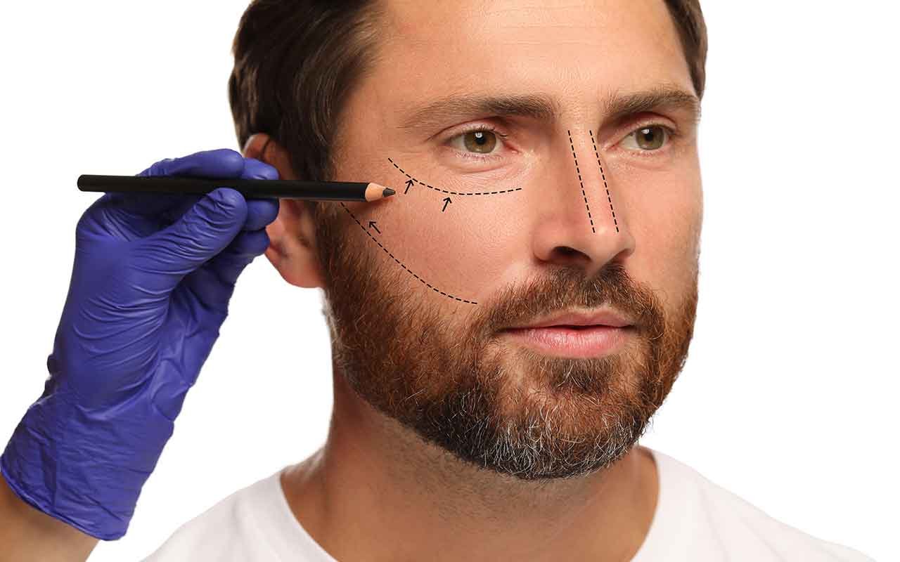 blépharoplastie pour homme