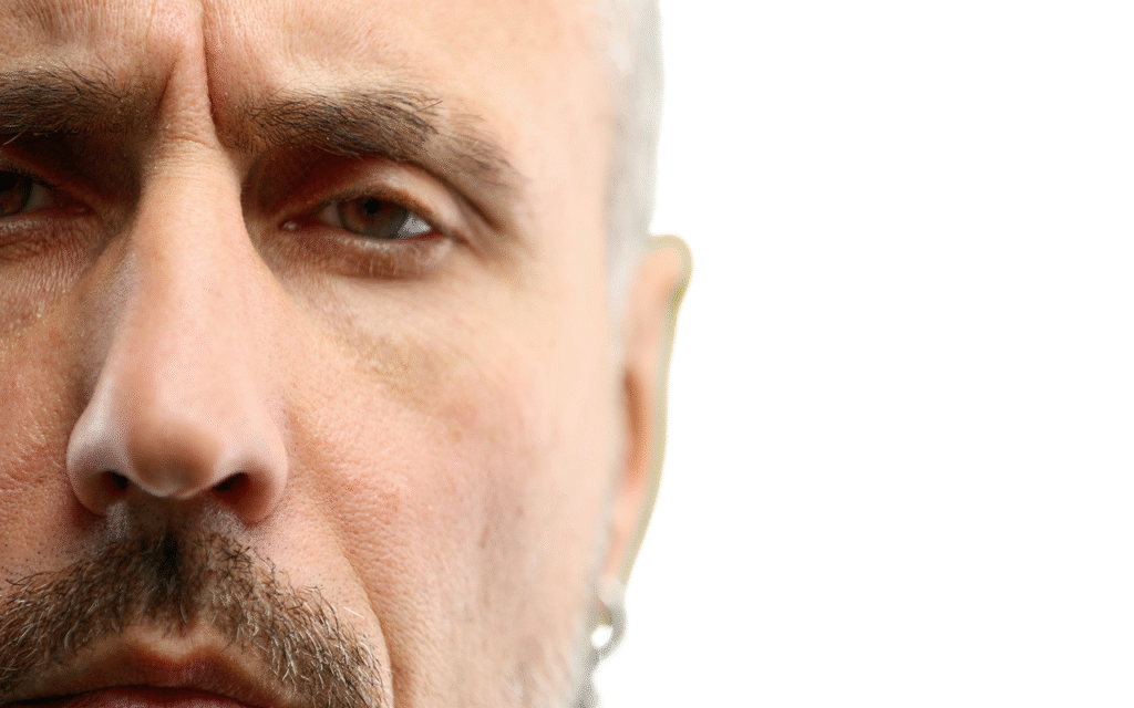 rhinoplastie fonctionnelle