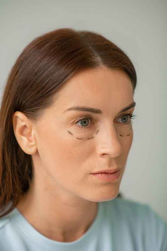 faire un lifting du regard en Tunisie