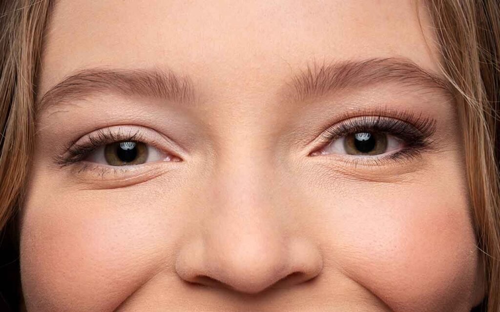 chirurgie-regard-fatiguée